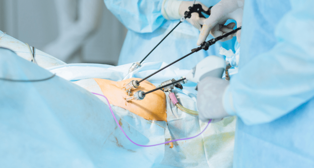 Laparoscopy Treatment in Varanasi