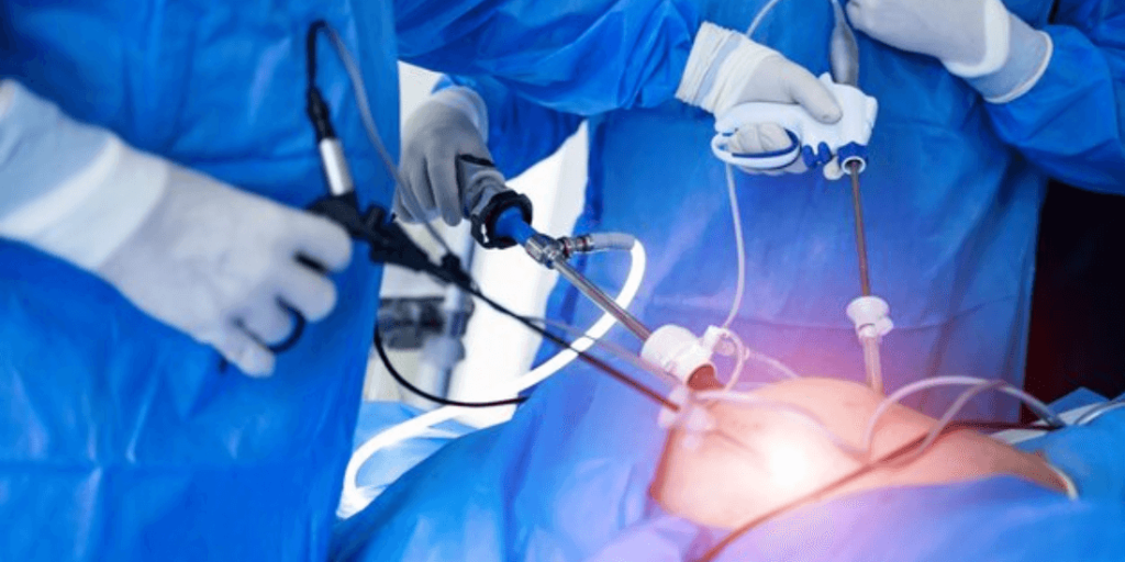 Laparoscopic Surgery
